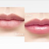 Dr.PEPTI Volume Essential Lip Plumper (Rose Color) - Dr.PEPTI Volume Essential Lip Plumper (Rose Color)